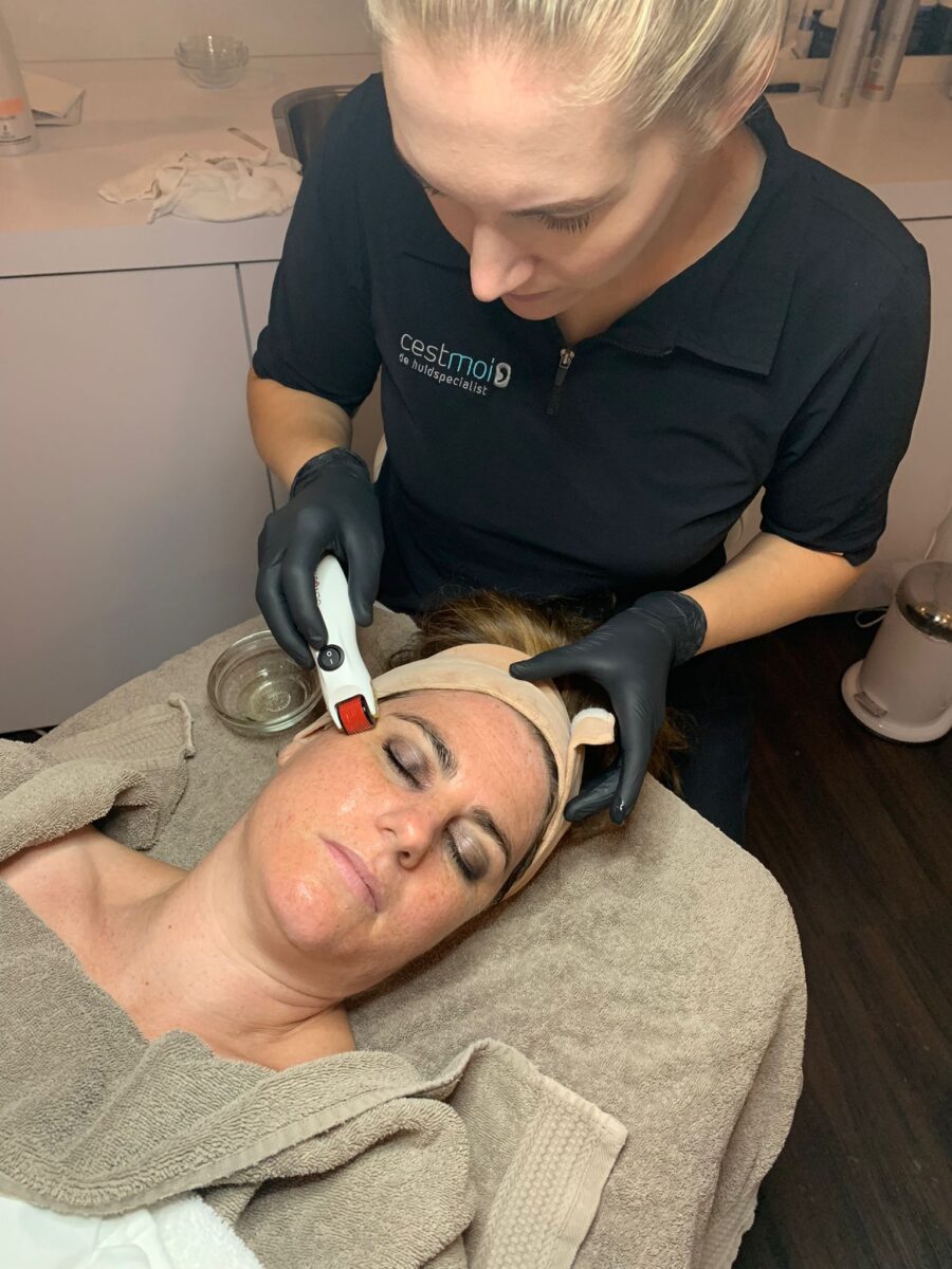 Microneedling met Genosys