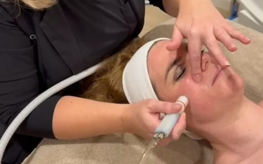 Hydrabrasie: De ultieme dieptereiniging voor een stralende huid